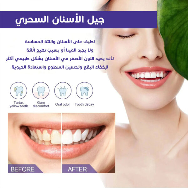 ⁦عرض 1+1 هدية جيل تبييض الاسنان السحري⁩ - الصورة ⁦4⁩