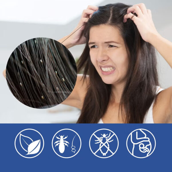 ⁦مشط إزالة القمل الكهربائي+بخاخ علاج فعال للقمل امن للاطفال والكبار⁩ - الصورة ⁦2⁩